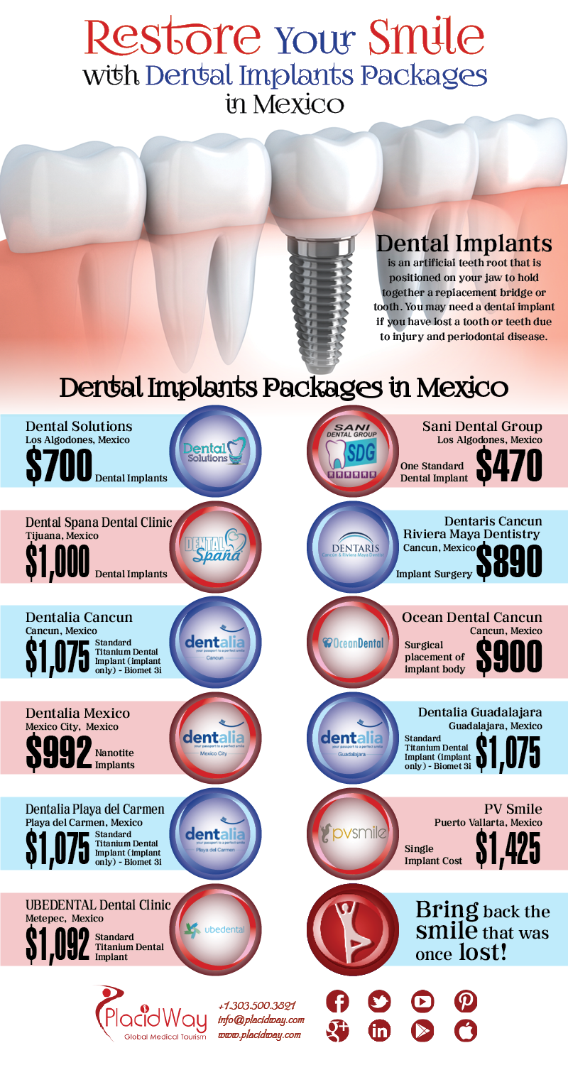 Dental Implants Packages in Mexico Archives PlacidBlog Your