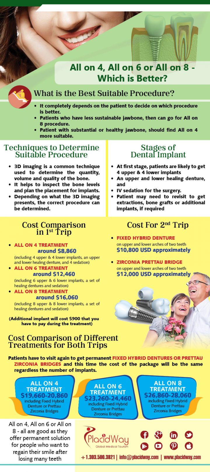 Infographics All on 4, All on 6 or All on 8 Which is the Best Dental